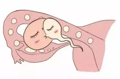 女同伴侣借卵代怀
